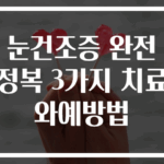 눈건조증 완전 정복 3가지 치료와예방법