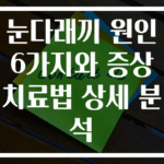 눈다래끼 원인 6가지와 증상 치료법 상세 분석