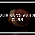 복숭아뼈 통증 부음 원인과 치료법 3가지