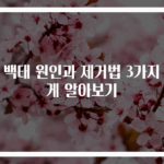 혀 백태 원인과 제거법 3가지 쉽게 알아보기