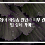 신생아 비립종 원인과 피부 관리법 상세 가이드