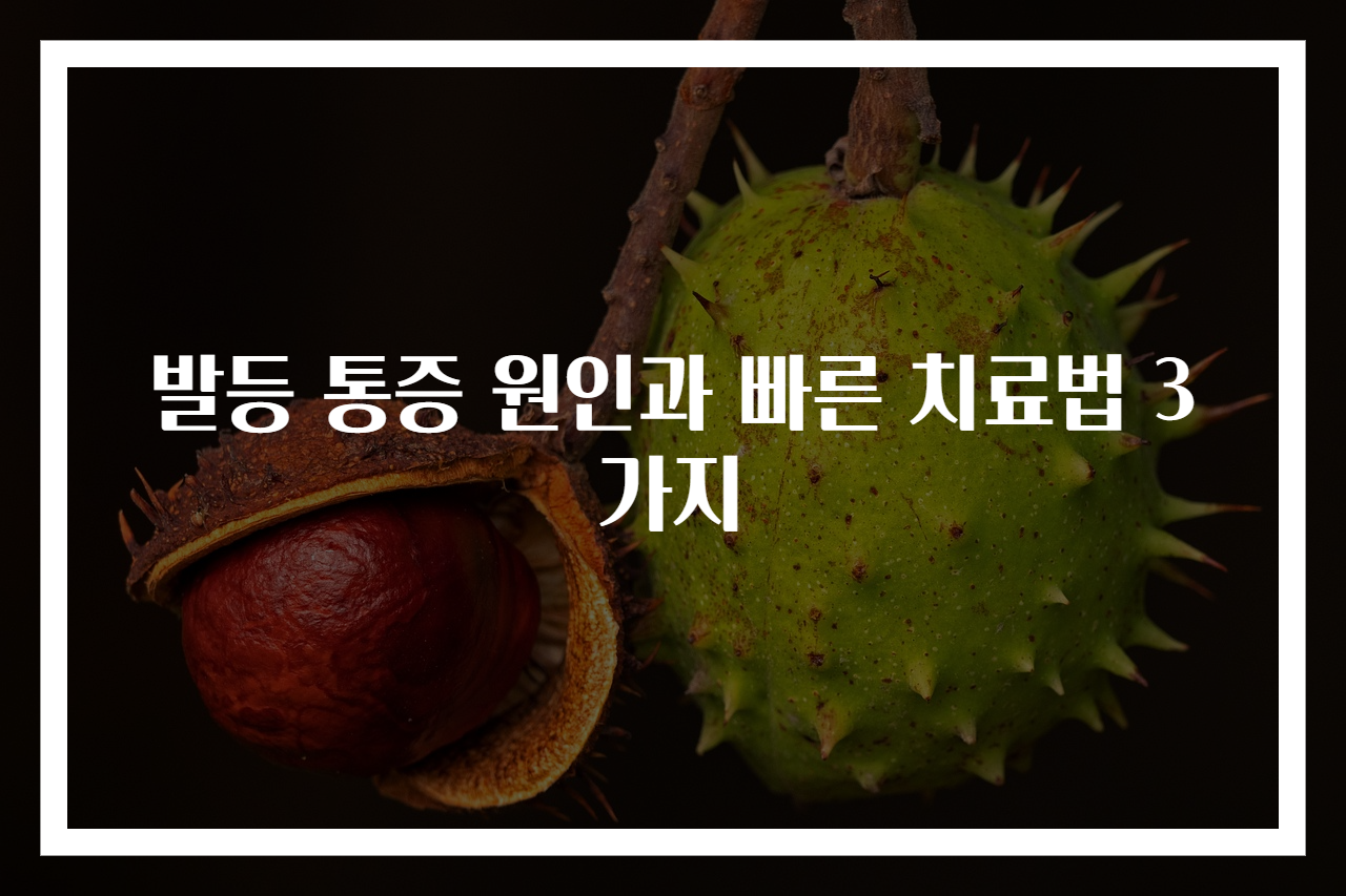 발등 통증 원인과 빠른 치료법 3가지