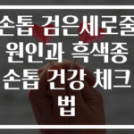 손톱 검은세로줄 원인과 흑색종 손톱 건강 체크법
