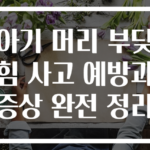 아기 머리 부딪힘 사고 예방과 증상 완전 정리