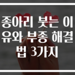 종아리 붓는 이유와 부종 해결법 3가지